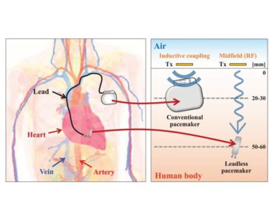 Influence of Heterogeneous Human Body on Midfield Wireless Power Transfer for Implantable Heart Devices