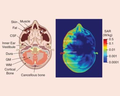 Acoustic Pressures in the Head From Pulsed Microwaves: Can They Explain “Anomalous” Health Incidents?